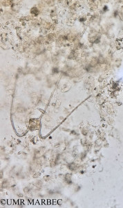 phyto/Brazilian_Amazon_coast/Amazomix_station_20/AMAZOMIX September 2021/Tripos gallicus (Am_St_20_r2_int2_Tripos_massilienses_conf_deflexum9)(copy)_thumb.jpg